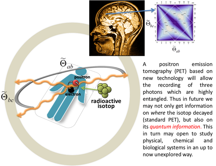 PET scan